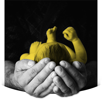 closeup black and white photo of father holding bright yellow jaundiced baby in both hands